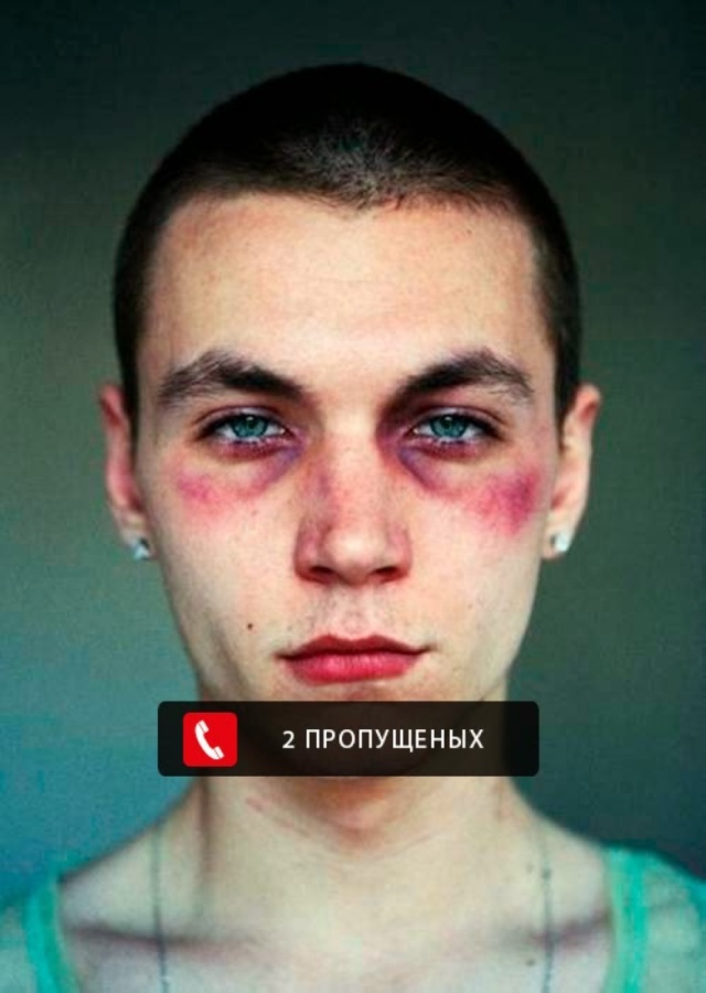 640x900, 124 Kb / лицо, фингал, пропущенный