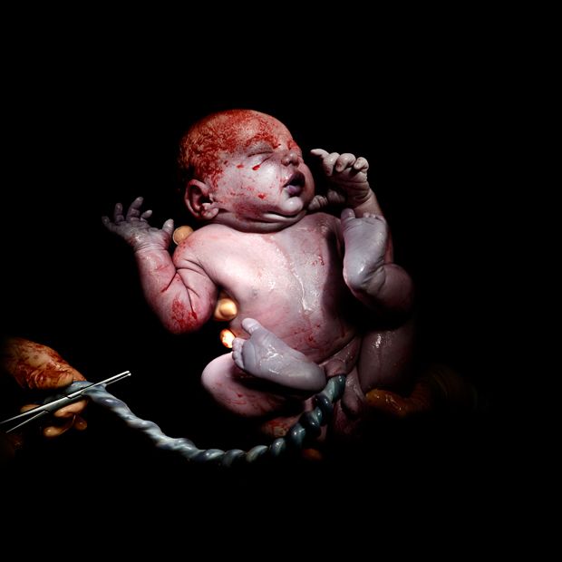 620x620, 25 Kb / младенец, пуповина